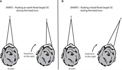 The Video Head Impulse Test